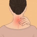 ストレートネック どこが痛い